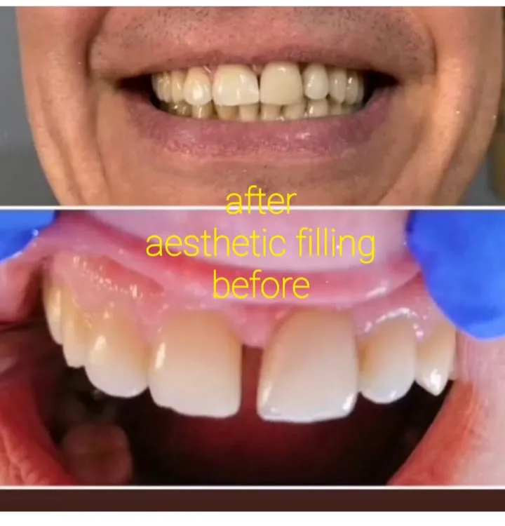 Alanya HEALTHY TEETH Dental Aesthetic — Médecine à Alanya: Commande en ligne, prix et avis