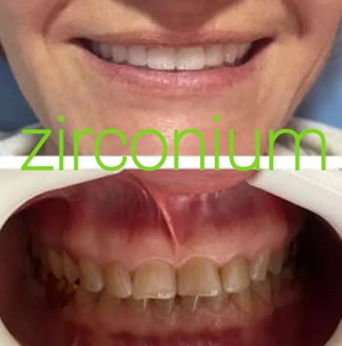 Alanya HEALTHY TEETH Dental Aesthetic — Médecine à Alanya: Commande en ligne, prix et avis