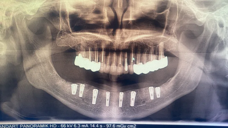 Alanya HEALTHY TEETH Dental Aesthetic — Médecine à Alanya: Commande en ligne, prix et avis