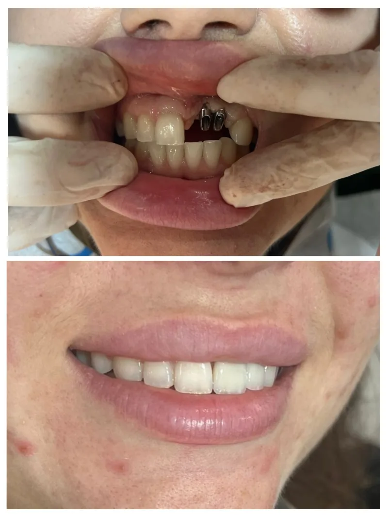 Alanya HEALTHY TEETH Dental Aesthetic — Médecine à Alanya: Commande en ligne, prix et avis