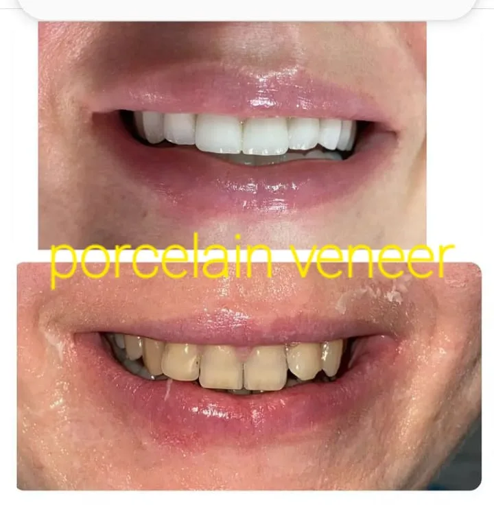 Alanya HEALTHY TEETH Dental Aesthetic — Médecine à Alanya: Commande en ligne, prix et avis